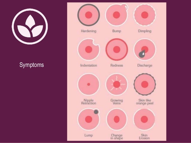 detecting a lump in the breast Detecting a lump in the breast